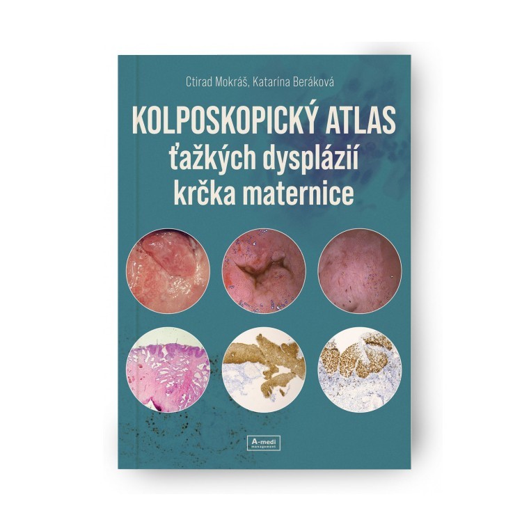 Kolposkopický atlas